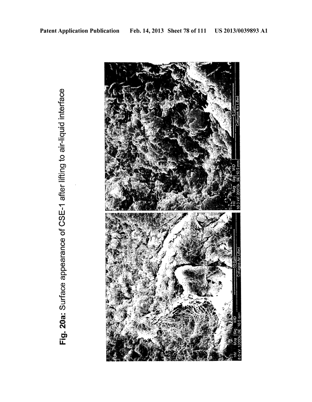 ISOLATION AND CULTIVATION OF STEM/PROGENITOR CELLS FROM THE AMNIOTIC     MEMBRANE OF UMBILICAL CORD AND USES OF CELLS DIFFERENTIATED THEREFROM - diagram, schematic, and image 79