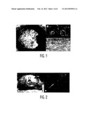 ADULT STEM CELLS/PROGENITOR CELLS AND STEM CELL PROTEINS FOR TREATMENT OF     EYE INJURIES AND DISEASES diagram and image