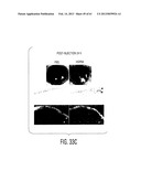 ADULT STEM CELLS/PROGENITOR CELLS AND STEM CELL PROTEINS FOR TREATMENT OF     EYE INJURIES AND DISEASES diagram and image