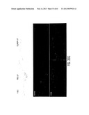 ADULT STEM CELLS/PROGENITOR CELLS AND STEM CELL PROTEINS FOR TREATMENT OF     EYE INJURIES AND DISEASES diagram and image