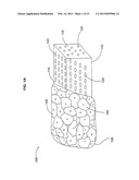 Bone Semi-Permeable Device diagram and image