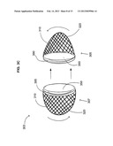 Bone Semi-Permeable Device diagram and image