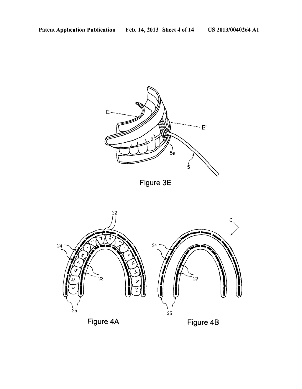 ULTRASONIC METHOD AND DEVICES FOR DENTAL TREATMENT - diagram, schematic, and image 05