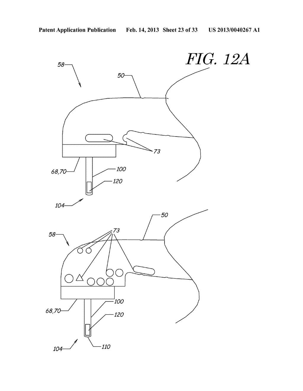 APPARATUS, METHODS, AND COMPOSITIONS FOR ENDODONTIC TREATMENTS - diagram, schematic, and image 24