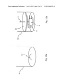 ARRANGEMENT FOR DETECTION OF HEMOLYSIS diagram and image