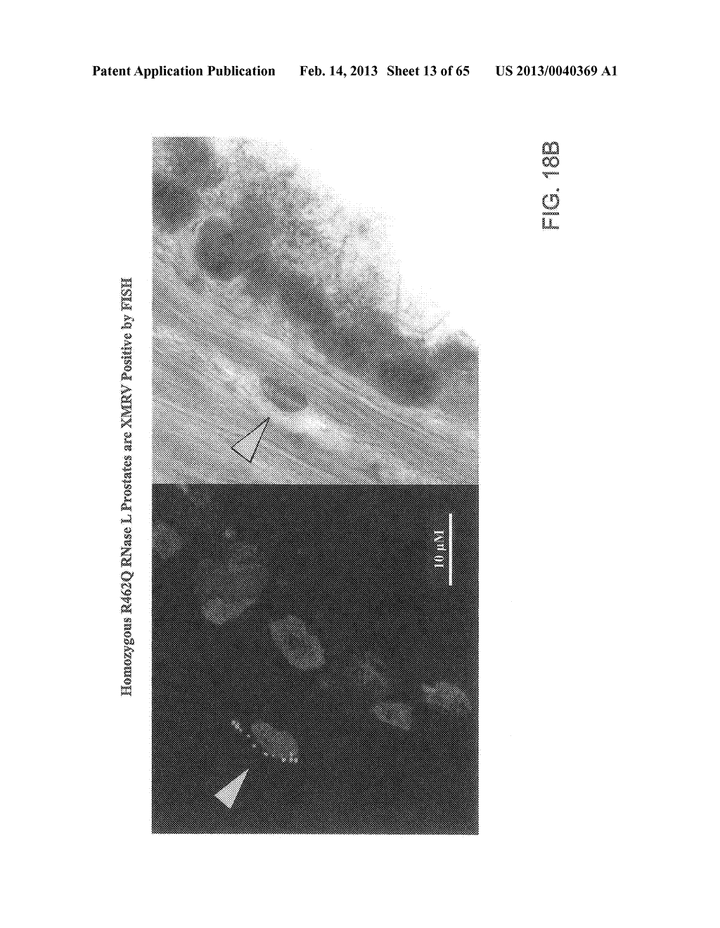 Gammaretrovirus Associated With Cancer - diagram, schematic, and image 14