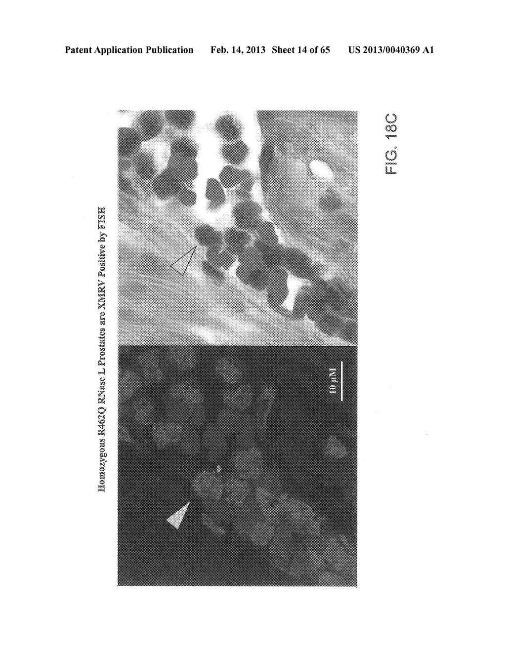 Gammaretrovirus Associated With Cancer - diagram, schematic, and image 15