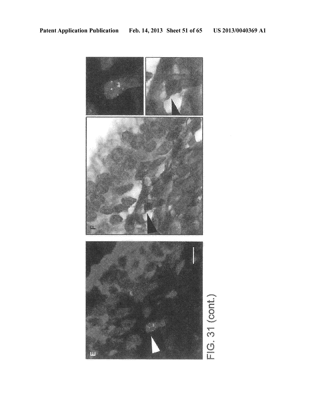 Gammaretrovirus Associated With Cancer - diagram, schematic, and image 52