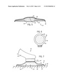 Multi-Layer Surface Treatment Pad For Motorized Device diagram and image