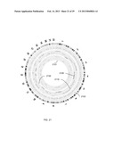 DETECTION OF GENETIC OR MOLECULAR ABERRATIONS ASSOCIATED WITH CANCER diagram and image