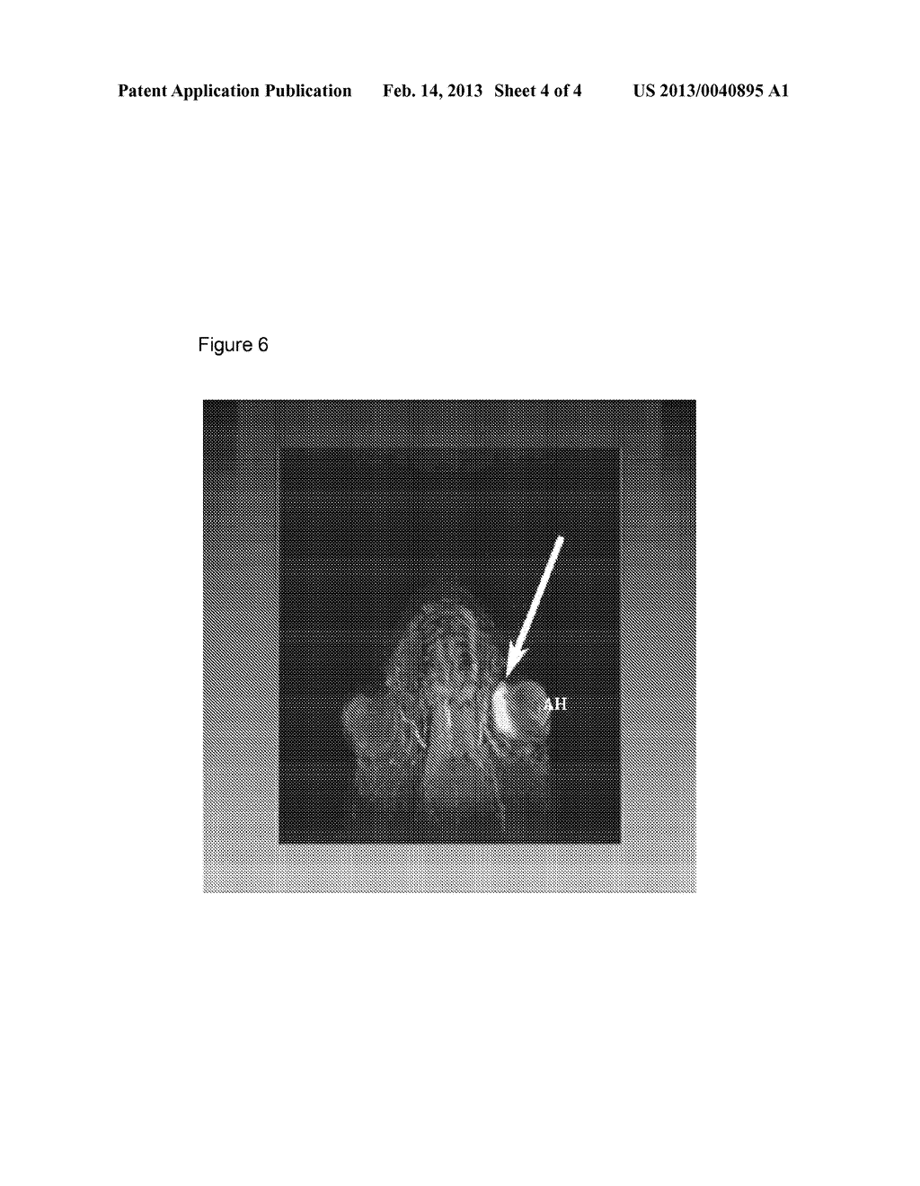 Pharmaceutical Formulations and Methods for Treating Ocular Conditions - diagram, schematic, and image 05