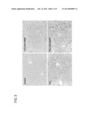 Use of PEDF-Derived Polypeptides for Treating Liver Cirrhosis diagram and image