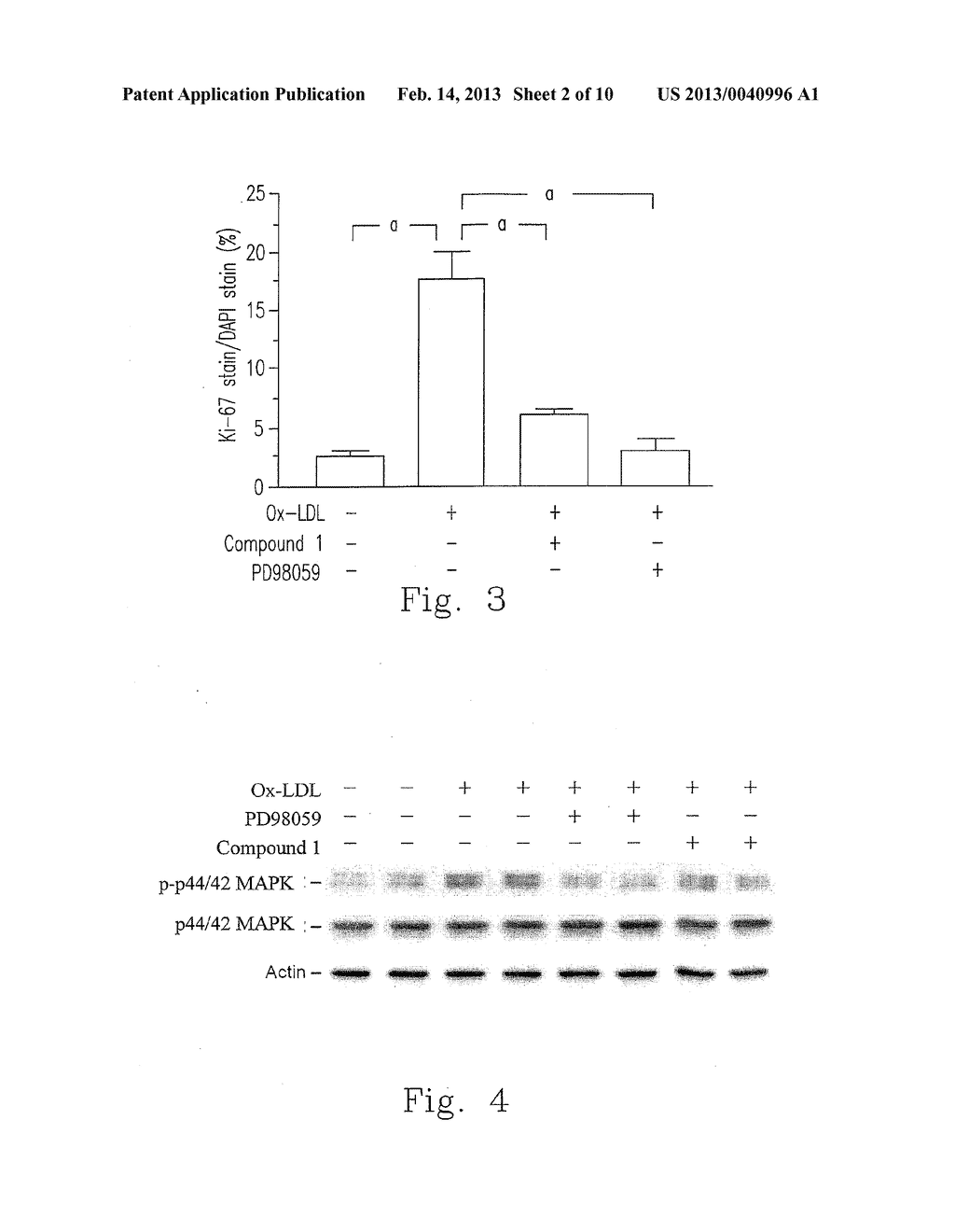 COMPOSITION FOR TREATING ATHEROSCLEROSIS AND A PREPARATION METHOD THEREOF - diagram, schematic, and image 03