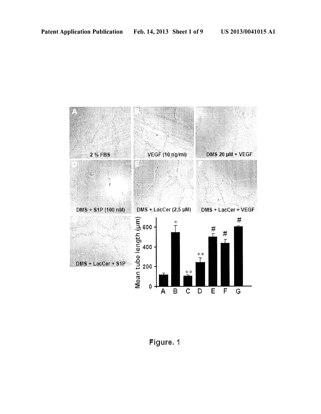 Use of the Lactosylceramide Synthase Isoform B1,4GALT-V as a Biomarker for     Cancer - diagram, schematic, and image 02