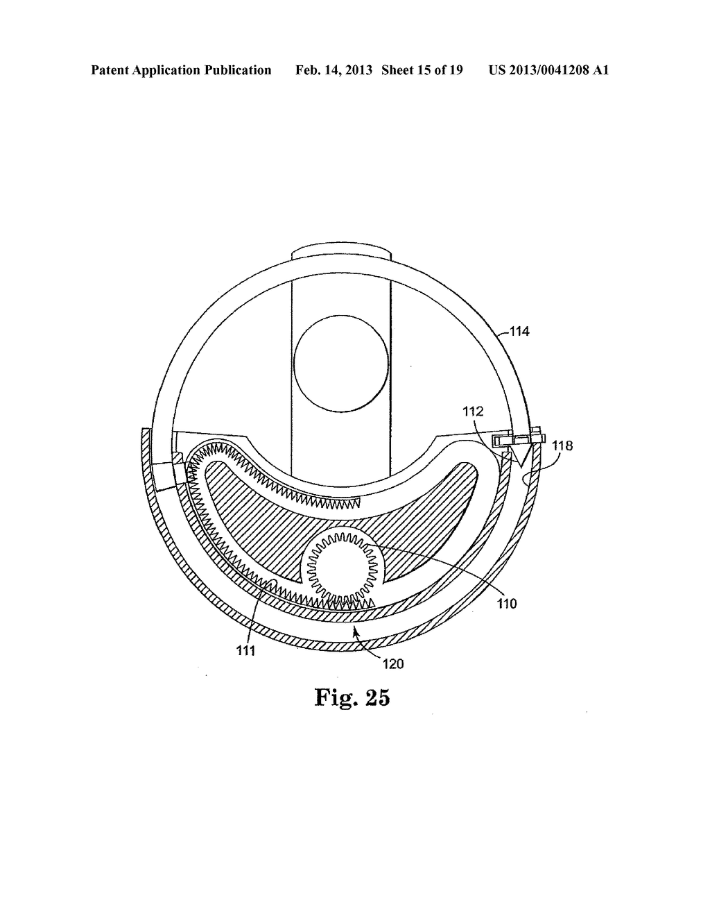 SURGICAL ARTICLES FOR PLACING AN IMPLANT ABOUT A TUBULAR TISSUE STRUCTURE     AND METHODS - diagram, schematic, and image 16