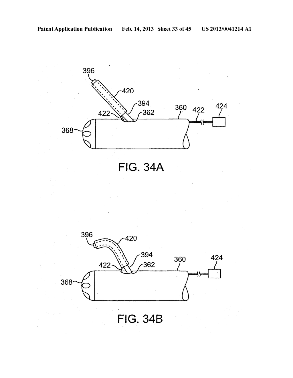 METHODS AND APPARATUS FOR OFF-AXIS VISUALIZATION - diagram, schematic, and image 34