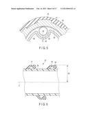 ENDOSCOPE diagram and image