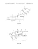 ENDOSCOPE diagram and image