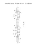 ENDOSCOPE diagram and image