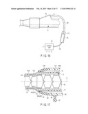 ENDOSCOPE diagram and image