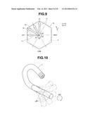 ENDOSCOPE diagram and image