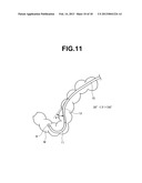 ENDOSCOPE diagram and image