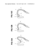 ENDOSCOPE diagram and image