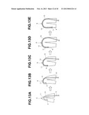 ENDOSCOPE diagram and image