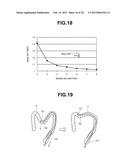 ENDOSCOPE diagram and image