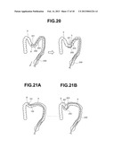 ENDOSCOPE diagram and image