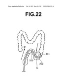 ENDOSCOPE diagram and image