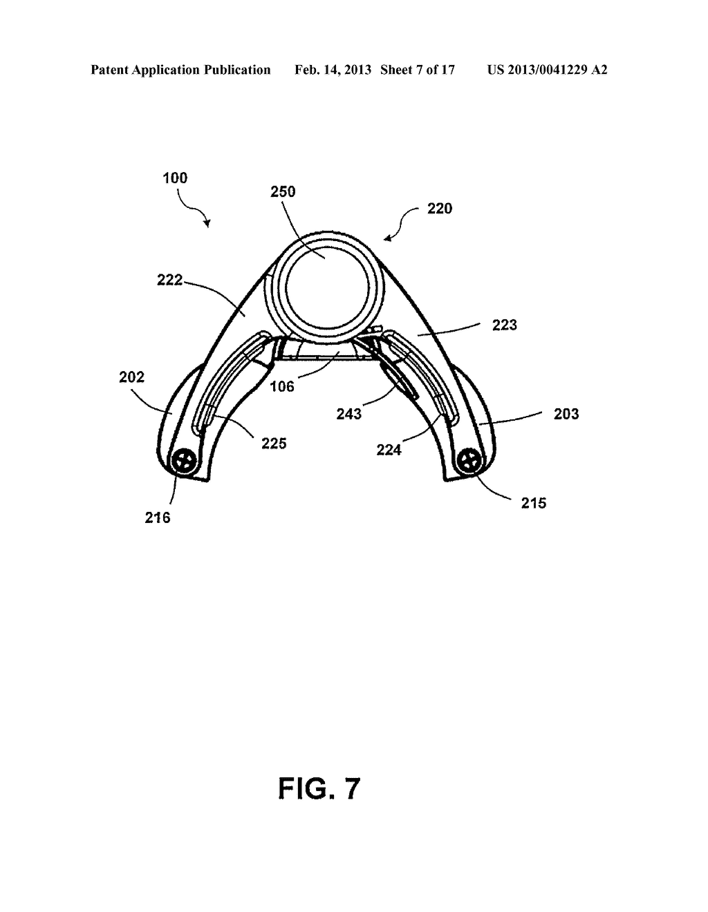 MINIMALLY OBSTRUCTIVE RETRACTOR - diagram, schematic, and image 08