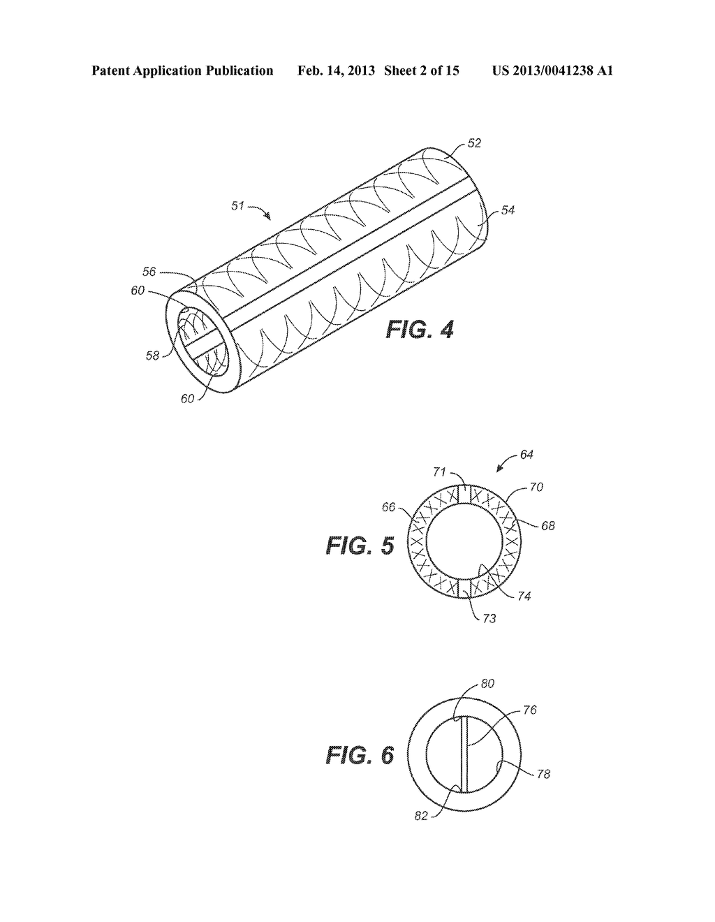 ELECTROCHEMICAL DISINFECTION OF IMPLANTED CATHETERS - diagram, schematic, and image 03