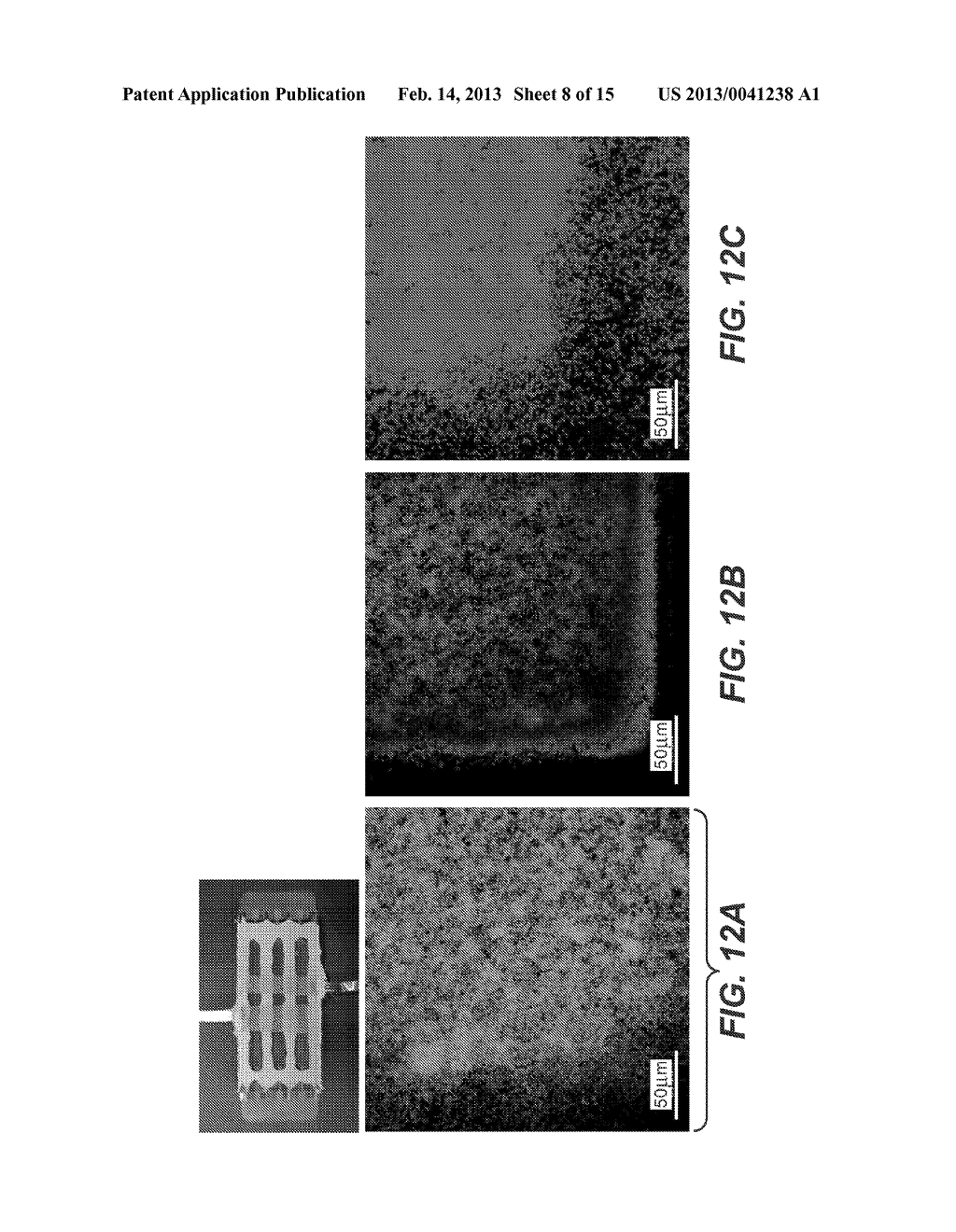 ELECTROCHEMICAL DISINFECTION OF IMPLANTED CATHETERS - diagram, schematic, and image 09