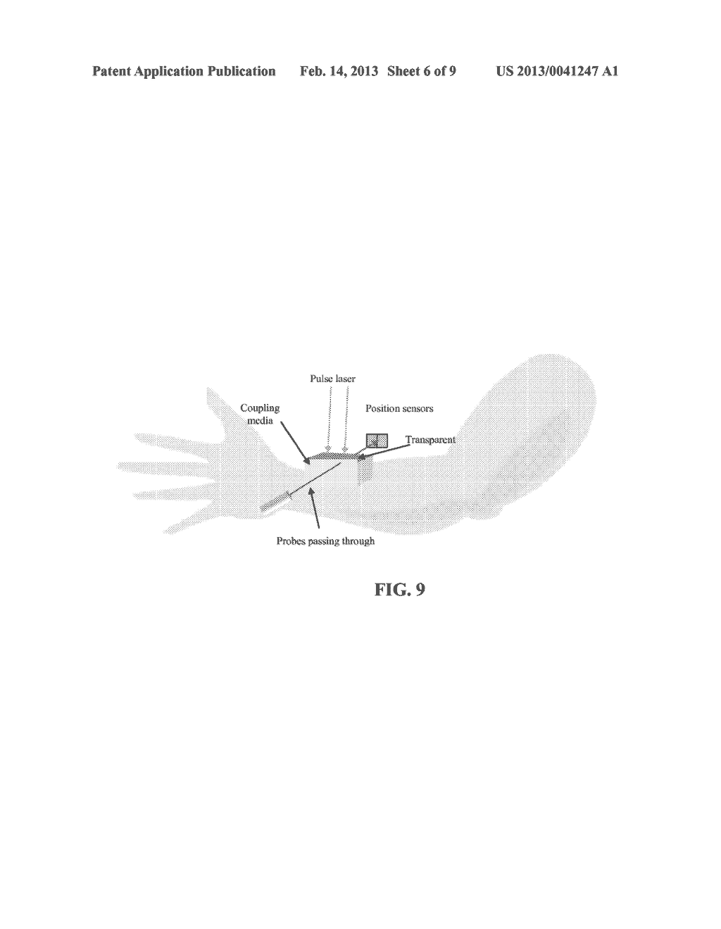 OPTOACOUSTIC / PHOTOACOUSTIC / ACOUSTIC IMAGING SYSTEM USING PROBE BEAM     DEFLECTION - diagram, schematic, and image 07