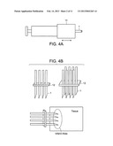 METHODS AND APPARATUS FOR INTRODUCING CELLS AT A TISSUE SITE diagram and image