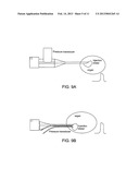 METHODS AND APPARATUS FOR INTRODUCING CELLS AT A TISSUE SITE diagram and image