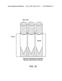 METHODS AND APPARATUS FOR INTRODUCING CELLS AT A TISSUE SITE diagram and image