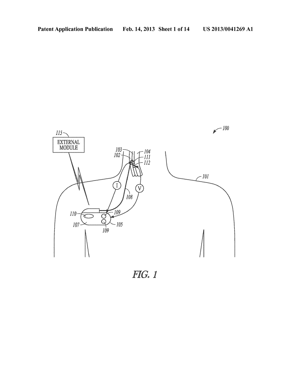 METHOD AND APPARATUS FOR DETERMINATION OF PHYSIOLOGICAL PARAMETERS USING     CERVICAL IMPEDANCE - diagram, schematic, and image 02