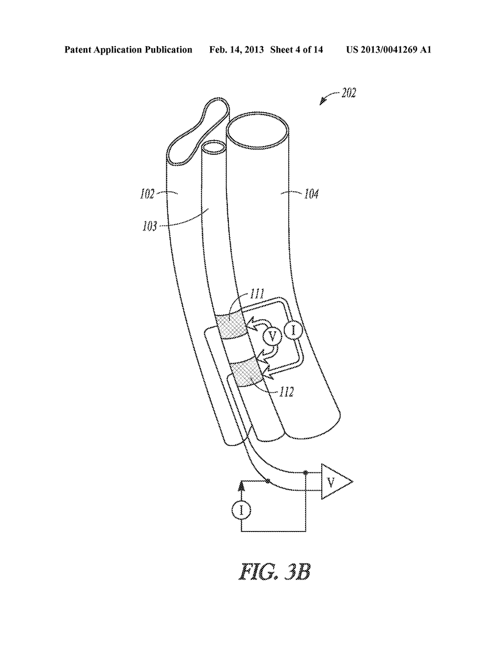 METHOD AND APPARATUS FOR DETERMINATION OF PHYSIOLOGICAL PARAMETERS USING     CERVICAL IMPEDANCE - diagram, schematic, and image 05