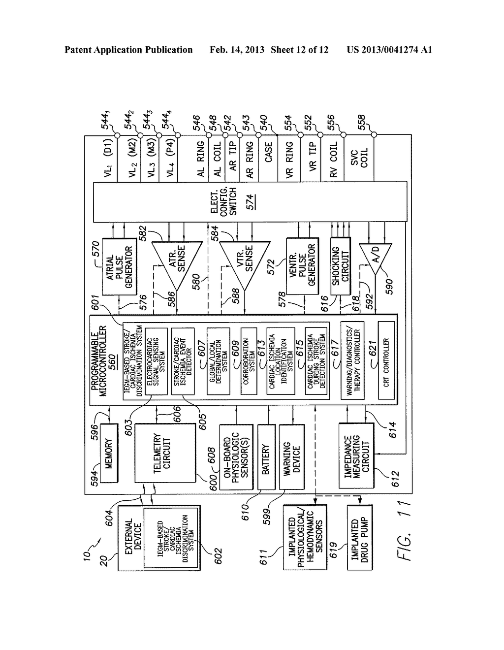 SYSTEMS AND METHODS FOR USE BY IMPLANTABLE MEDICAL DEVICES FOR DETECTING     AND DISCRIMINATING STROKE AND CARDIAC ISCHEMIA USING ELECTROCARDIAC     SIGNALS - diagram, schematic, and image 13