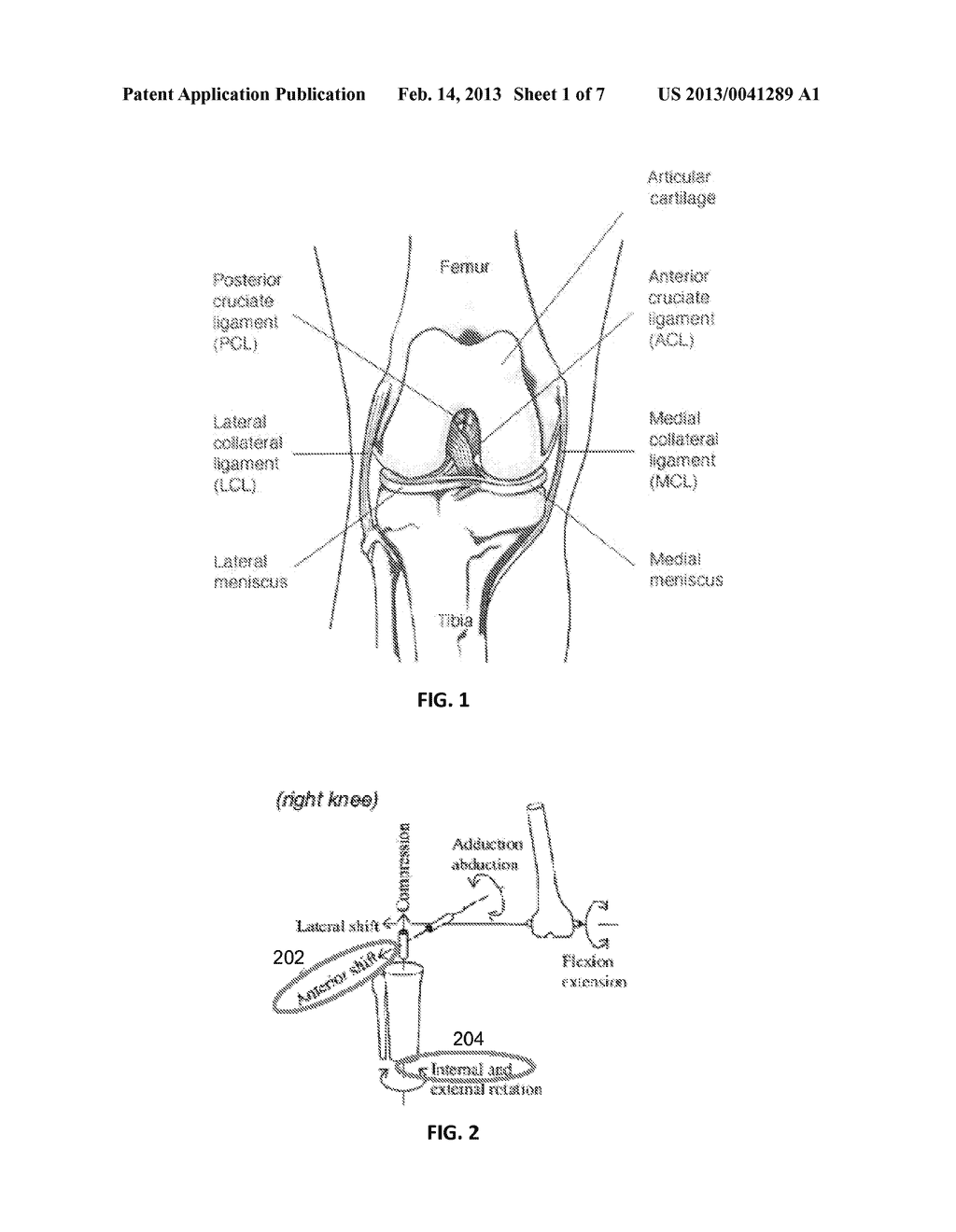 MECHANICAL PIVOT SHIFT MEASUREMENT TO EVALUATE JOINTS - diagram, schematic, and image 02