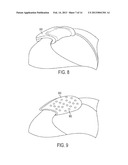 FLEXIBLE ANATOMICAL SUPPORT diagram and image