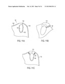 FLEXIBLE ANATOMICAL SUPPORT diagram and image