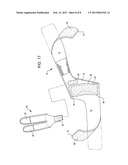 FUNCTIONAL EXERCISE GLOVE AND 19+19 DEGREE ERGONOMIC BRACING DEVICES diagram and image