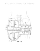 DEVICE AND METHOD FOR CONTROL OF HEMORRHAGE diagram and image