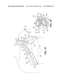 DEVICE AND METHOD FOR CONTROL OF HEMORRHAGE diagram and image