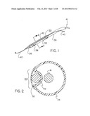 CATHETER WITH DISRUPTABLE GUIDEWIRE CHANNEL diagram and image