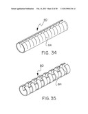 CATHETER WITH DISRUPTABLE GUIDEWIRE CHANNEL diagram and image