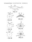 CATHETER WITH DISRUPTABLE GUIDEWIRE CHANNEL diagram and image